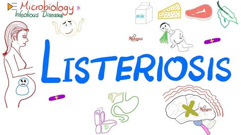 Listeriosis Disease Listeria Food Poisoning Microbiology 🧫