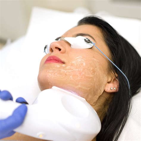 Ipl For Aging Skin Photorejuvenation Nascent Skin Clinic