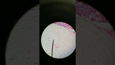 The disklike expansion of the end of a nerve fiber together with a closely associated merkel cell that has a presumed tactile function. Merkel cells, meissner's corpuscles, pacinian corpuscles ...