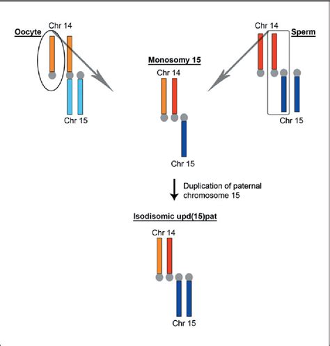 Angelman Syndrome Chromosome 15