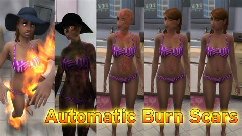Mod The Sims Automatic Burn Scars Skin Detail Update 37