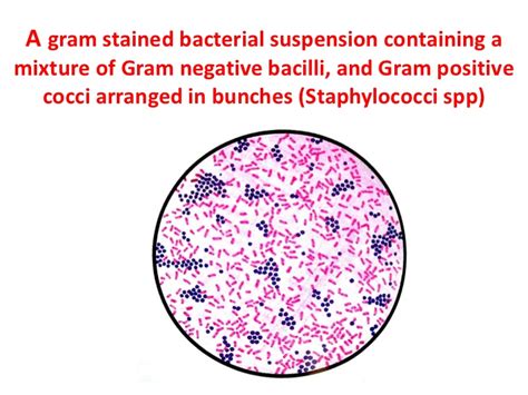 Toxin production it is more accurate to write under gram negative bacteria exotoxins and/or endotoxins rather than exotoxins or endotoxins because endotoxins are produced by. What are some examples of gram-negative bacteria? | Socratic