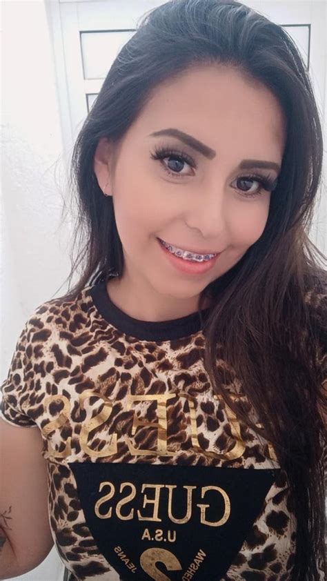 how s your day going guys🥰 r amature braces