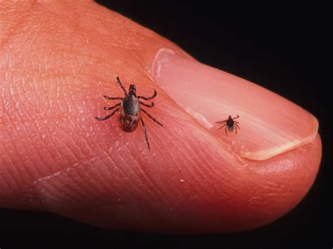 Lyme Disease Risk In The Us Is Expanding In All Directions Business