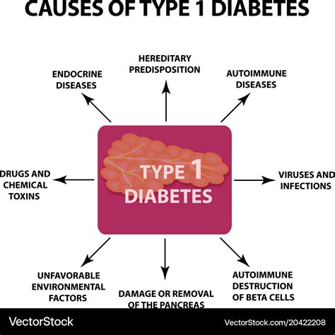 Causes Diabetes Type 1 Infographics Royalty Free Vector
