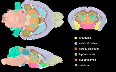 Pdf Genetic Dissection Of The Mouse Brain Using High Field Magnetic