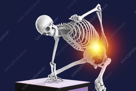 Back Pain Illustration Stock Image F0340111 Science Photo Library