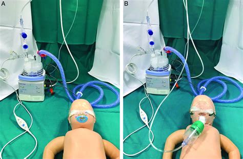 Incorporating A Nebulizer System Into High Flow Nasal Cannula Improves Comfort In Infants With