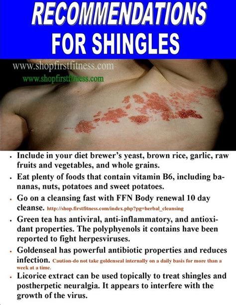 Health Shingles Risking Nerve Pain And The Natural Ways To Prevent