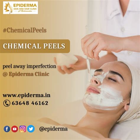 Ppt Chemical Peeling Treatment Best Skin Clinic In Jayanagar