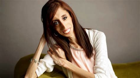 Worlds Ugliest Woman Lizzie Velasquez Making Documentary On How To