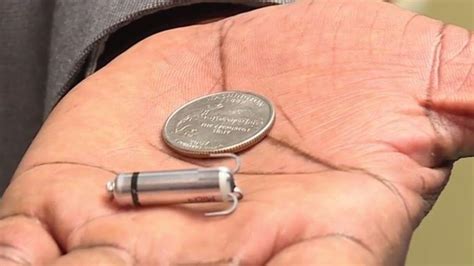 Heart Rhythm Clinic Of Michigan Worlds Smallest Pacemaker In Mid