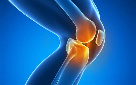 Knee Osteoarthritis Physio Treatment Ocean Reef Physio