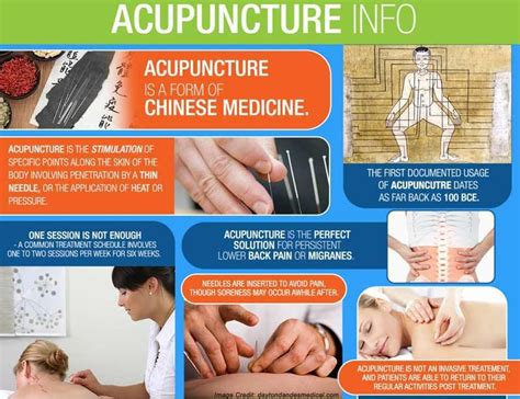 Surprising Health Benefits Of Acupuncture You Dont Know Acupuncture Benefits Acupuncture