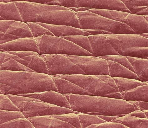 Skin Surface Sem Stock Image C0043587 Science Photo Library