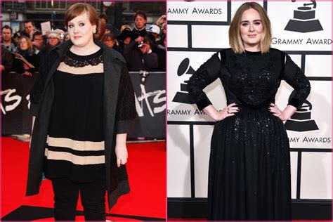 Adele Teeth Before And After