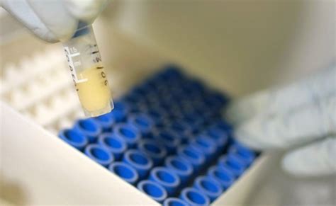 Nsw Trials New Hiv Drug Prep Thousands Of Men Enlist
