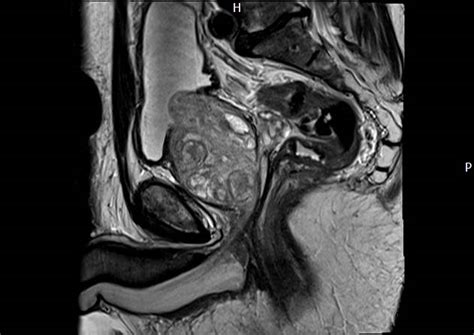 Prostate Mri Maryland Radiologist Charter Radiology