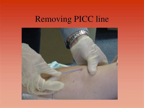 Ppt Picc And Midline Catheters Powerpoint Presentation Free Download