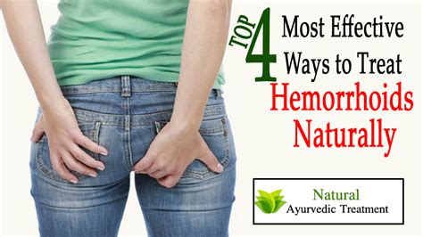 Top 4 Most Effective Ways To Treat Hemorrhoids Naturally