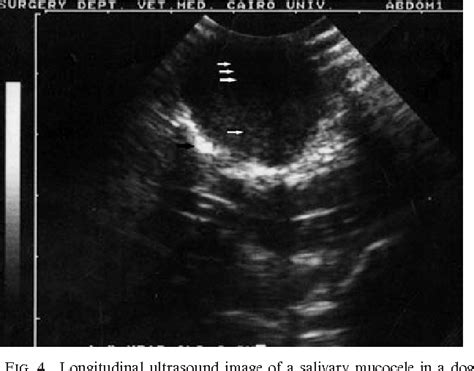 Figure 4 From Clinical And Ultrasonographic Characteristics Of Salivary