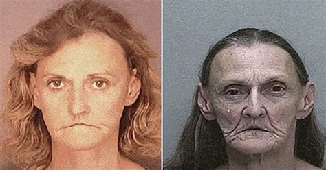 Faces Of Meth Horrific Transformation Of Fresh Faced Adults Into