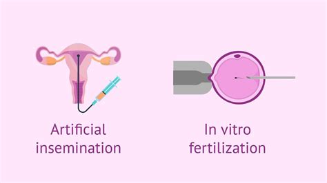 Assisted Reproductive Technology In The Philippines Technology