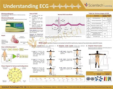 Understanding Ecg Icu Nursing Ekg Cardiac Nursing