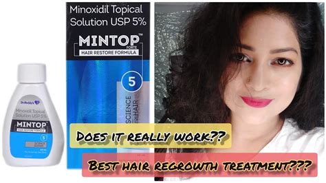 Original mintop minoxidil topical 10% foam hair regrowth serum by dr.reddy's is a super famous and 100% effective solution as well as a very rare product with an active ingredient minoxidil 10% maximum hair regrowth with mintop minoxidil topical 10% foam hair regrowth serum takes time. MINOXIDIL 5% (MINTOP) REVIEW - HOW TO USE, SIDE EFFECTS ...