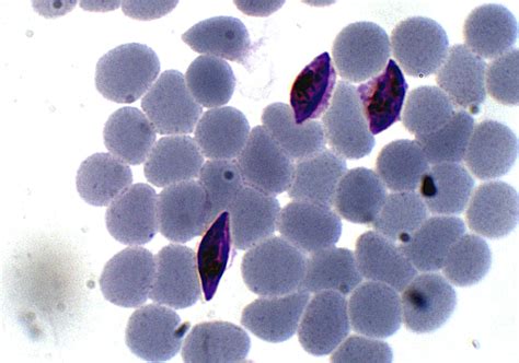 Plasmodium Falciparum Gametocyte Parasitology