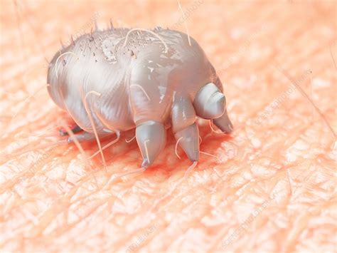 Illustration Of A Scabies Mite On Human Skin Stock Image F0237765