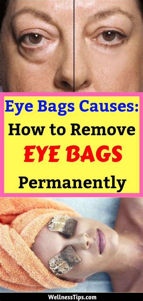 Incredible Howto Remove Eye Bags Ideas Beauty Shop