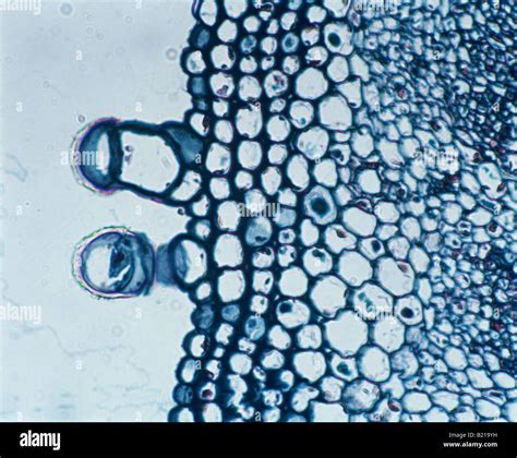 Cross Section Of Sunflower Stem Collenchyma Cells Walls Strengthened