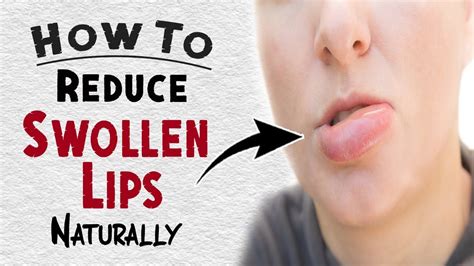 How To Reduce Swollen Lips Naturally Home Remedies For Swollen Lips