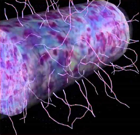 Cause of typhi salmonellosis (typhi fever, paratyphi a, b and c), salmonella enterica serotype typhi or paratyphi a, b and c include salmonella to the family of enterobacteriaceae. BioMight 3D Salmonella Typhi Animation - YouTube