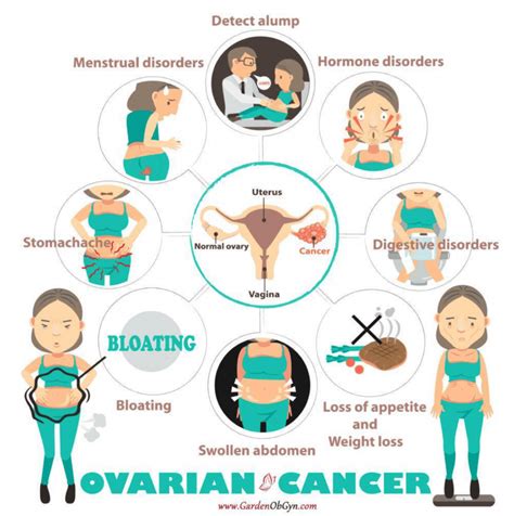 Ovarian Cancer The Importance Of Recognizing The Symptoms Garden Ob