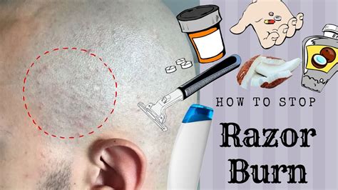 HOW TO STOP RAZOR BUMPS BURN Head Shave YouTube