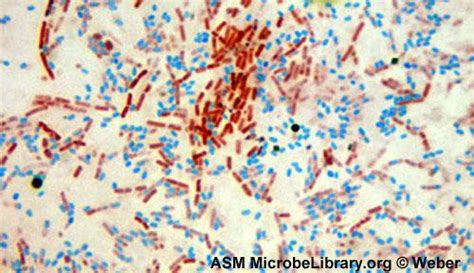 Endospore Staining Principle Procedure Results Microbe Online