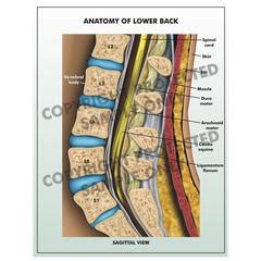 It affects up to 80% of americans at some pain. Legal Art Works — Stock Medical Illustrations