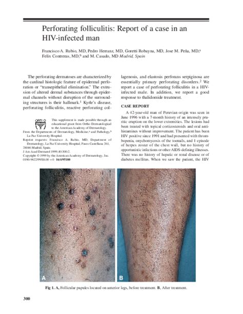 Pdf Perforating Folliculitis Report Of A Case In An Hiv Infected Man