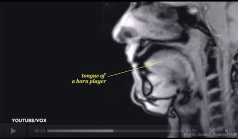 Mri Video Of Couple Having Sex Captured By The British Medical Journal