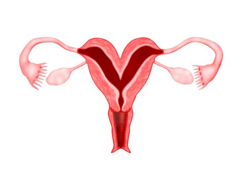 Chapter Congenital Uterine Abnormalities Melaka Fertility