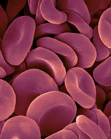 Images Of Red Blood Cells Under Microscope Micropedia