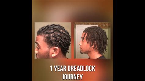 Dreadlock Journey 1 Year Youtube