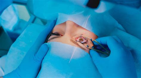 The Untold Truth Of Lasik Surgery