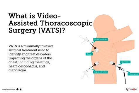 Video Assisted Thoracoscopic Surgery Vats Causes Symptoms Treatment And Cost