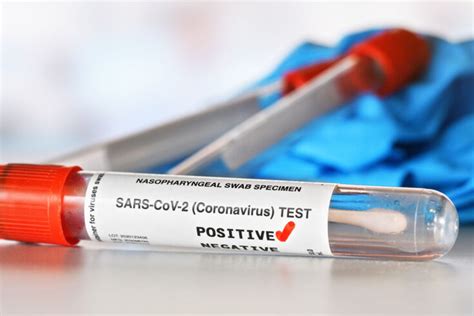 New Covid 19 Test Gives Accurate Results In Minutes Ukri