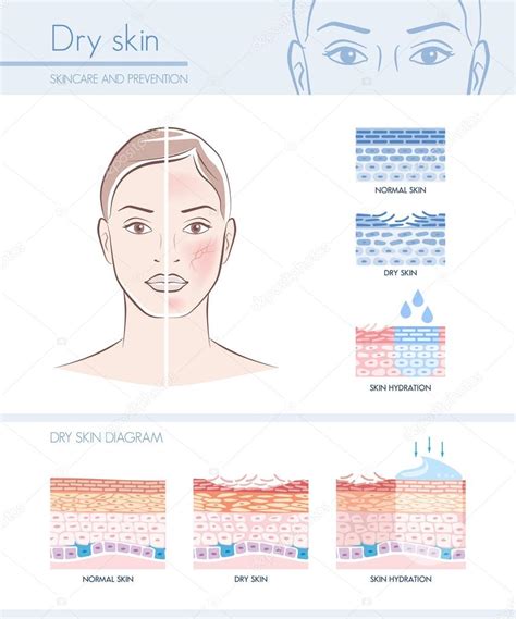 Hydration Infographic With Skin Diagram Stock Vector By ©elenabs 128206922