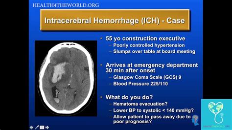 Intracerebral Hemorrhage Case Study Health4theworld Academy Left