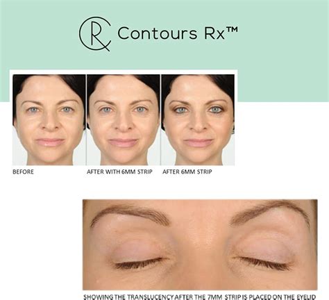 Contours Rx Lids By Design Eyelid Correcting Strips Set Of 80 8mm Eye